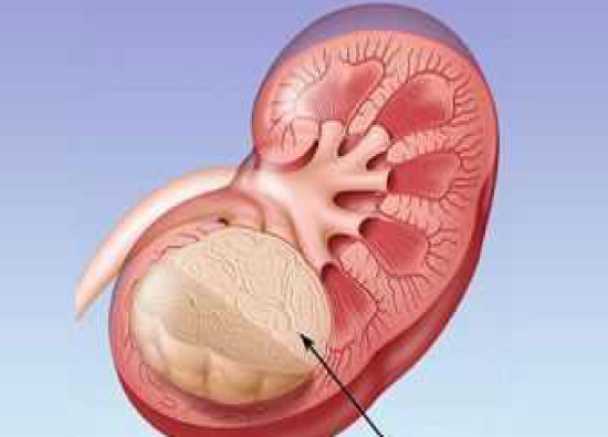 female urology 