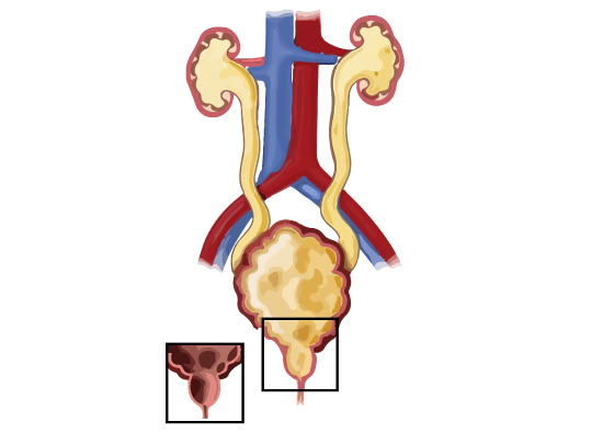 female urology 