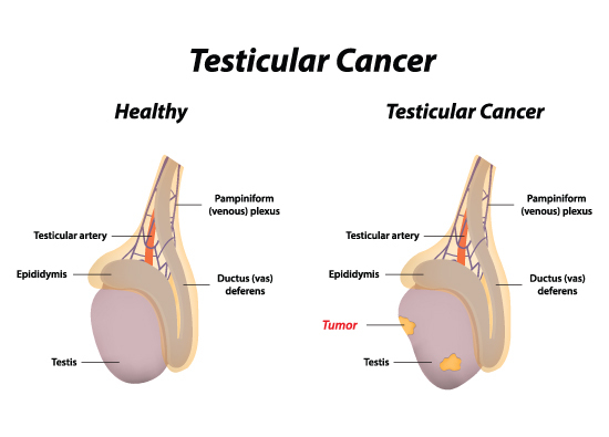 female urology 