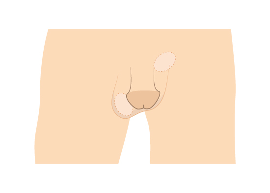 female urology 