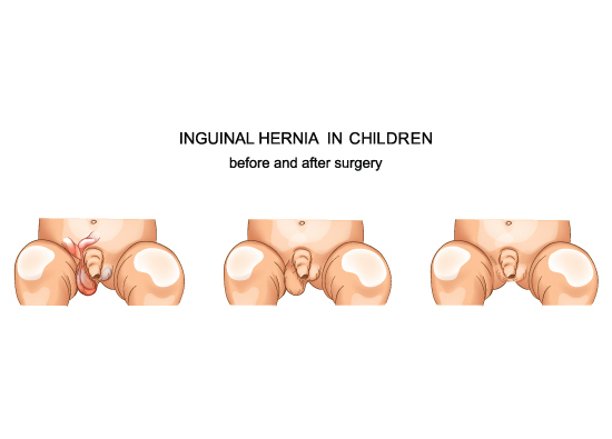 female urology 