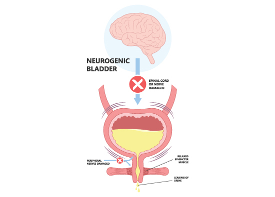 female urology 