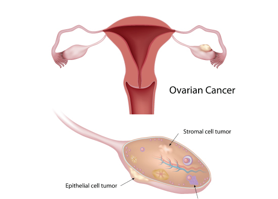 female urology 