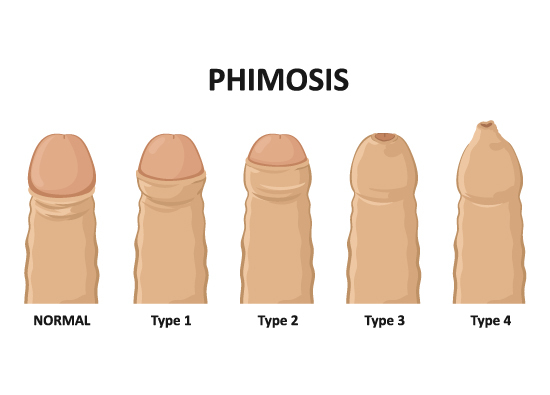 female urology 