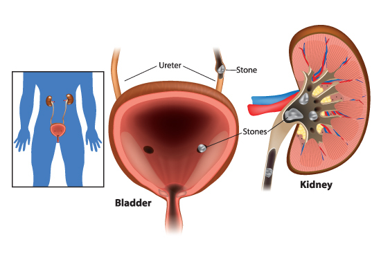 female urology 