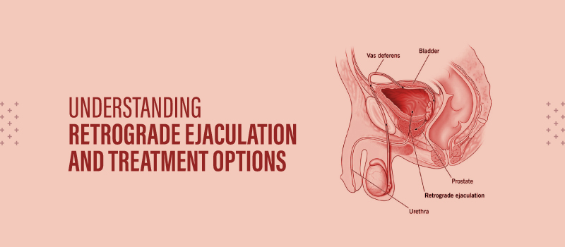 Understanding Retrograde Ejaculation and Treatment Options