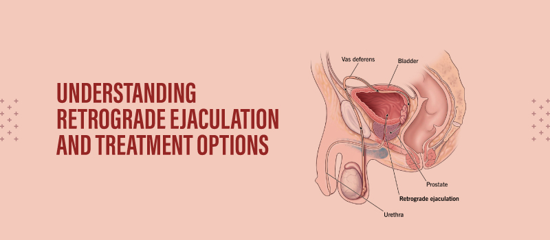 Understanding Retrograde Ejaculation and Treatment Options