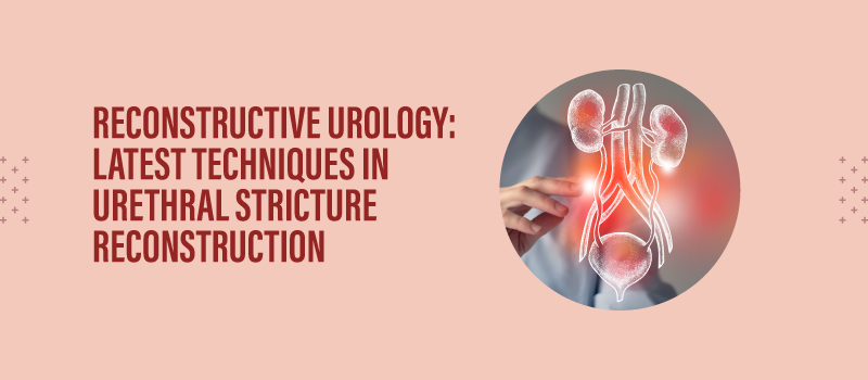 Reconstructive Urology: Latest Techniques in Urethral Stricture Reconstruction